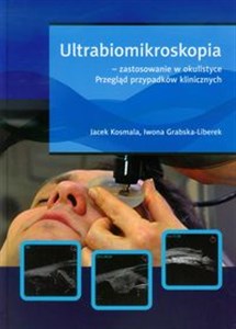 Ultrabiomikroskopia - zastosowanie w okulistyce Przegląd przypadków klinicznych