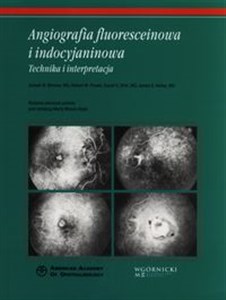 Angiografia fluoresceinowa i indocyjaninowa Technika i interpretacja