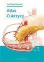 Atlas cukrzycy