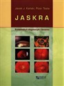 Jaskra Kompendium diagnostki i leczenia - Jacek J. Kański, Piotr Tesla