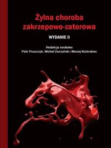 Żylna choroba zakrzepowo-zatorowa