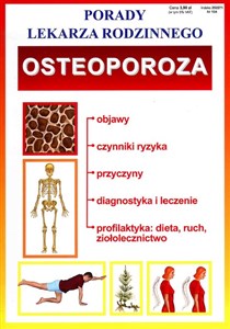 Osteoporoza Porady Lekarza Rodzinnego