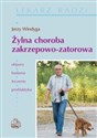 Żylna choroba zakrzepowo zatorowa