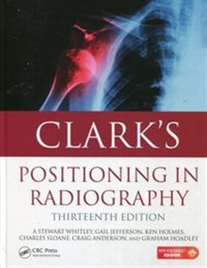 Clarks Positioning in radiography