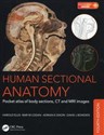 Human Sectional Anatomy Pocket atlas of body sections, CT and MRI images - Harold Ellis, Bari M. Logan, Adrian K. Dixon