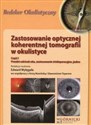 Zastosowanie optycznej koherentnej tomografii w okulistyce Część 1 Przedni odcinek oka, zastosowanie śródoperacyjne, jaskra - Edward Wylęgała