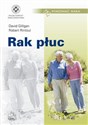 Rak płuc - David Gilligan, Robert Rintoul