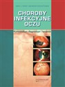 Choroby infekcyjne oczu Kompendium diagnostyki i leczenia - Jacek J. Kański, Agnieszka Kubicka-Trząska