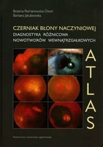 Czerniak błony naczyniowej Diagnostyka różnicowa nowotworów wewnątrzgałkowych Atlas