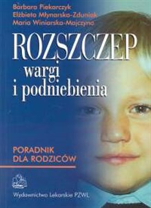 Rozszczep wargi i podniebienia