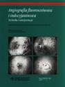 Angiografia fluoresceinowa i indocyjaninowa Technika i interpretacja
