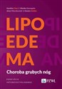 Lipoedema Choroba grubych nóg. Podejście interdyscyplinarne - Karolina Chęś, Monika Domagała, Artur Mieczkowski, Dorota Stettler