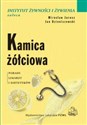 Kamica żółciowa