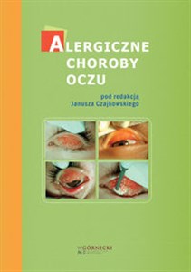 Alergiczne choroby oczu - Księgarnia UK