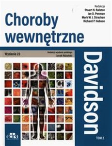 Davidson Choroby wewnętrzne Tom 2 - Księgarnia Niemcy (DE)