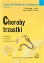 Choroby trzustki Porady lekarzy i dietetyków - Mirosław Jarosz, Jan Dzieniszewski