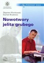 Nowotwory jelita grubego - Zbigniew Wronkowski, Szymon Brużewicz
