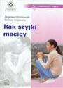 Rak szyjki macicy - Zbigniew Wronkowski, Szymon Brużewicz