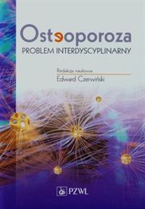 Osteoporoza Problem interdyscyplinarny - Księgarnia Niemcy (DE)