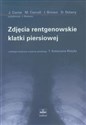 Zdjęcia rentgenowskie klatki piersiowej