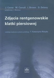 Zdjęcia rentgenowskie klatki piersiowej