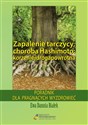 Zapalenie tarczycy, choroba Hashimoto