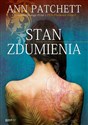 Stan zdumienia