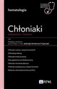 Chłoniaki. Diagnoza i terapia W gabinecie lekarza specjalisty. Hematologia