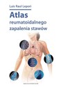 Atlas reumatoidalnego zapalenia stawów / DK Media