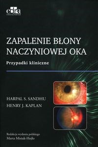 Zapalenie błony naczyniowej oka