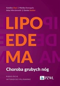 Lipoedema Choroba grubych nóg. Podejście interdyscyplinarne - Księgarnia Niemcy (DE)