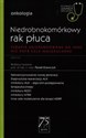 Niedrobnokomórkowy rak płuca W gabinecie lekarza specjalisty Terapie ukierunkowane na inne niż EGFR cele molekularne