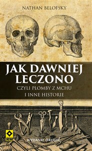 Jak dawniej leczono czyli plomby z mchu i inne historie - Księgarnia Niemcy (DE)