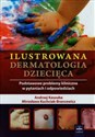 Ilustrowana dermatologia dziecięca Podstawowe problemy kliniczne w pytaniach i odpowiedziach