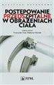 Postępowanie przedszpitalne w obrażeniach ciała - 