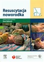 Resuscytacja noworodka - 